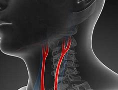 Image result for Carotid Artery Anatomy
