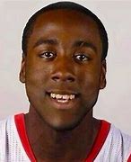 Image result for James Harden Balding