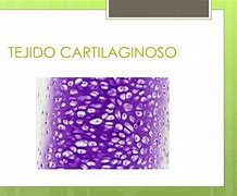 Image result for csrtilaginoso