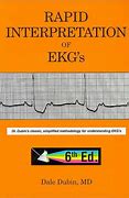 Image result for EKG Screen