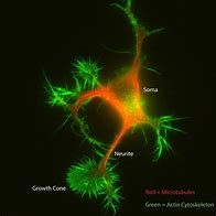 Image result for Soma Neuron