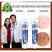 Image result for Wart Removal Ointment