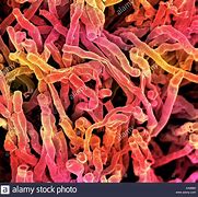 Image result for actinomuces