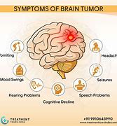 Image result for Head Cancer Symptoms