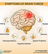 Image result for Head Tumor