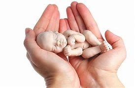 Image result for aborto