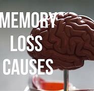 Image result for Losing Memory