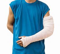 Image result for Broken Stick Out of Arm