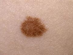 Image result for co_to_za_ziarnica