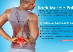 Image result for Sore Back Symptoms