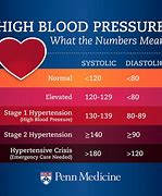 Image result for Blood Pressure Measurement