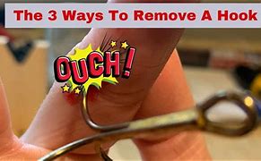 Image result for Remove Fish Hook