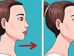 Image result for People with No Jawline