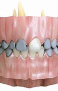 Image result for Anatomy of Central Incisor
