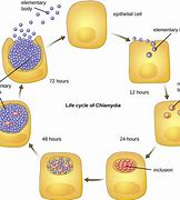 Image result for Chlamydia Infection
