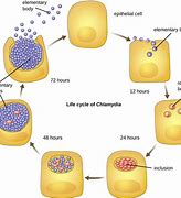 Image result for Chlamydia Disease