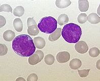Image result for cytochemia