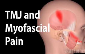 Image result for Jaw Bone Pain