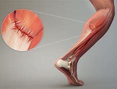 Image result for Foot and Ankle Pain
