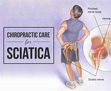 Image result for Sciatica and Chiropractic Treatment