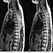 Image result for Full Spine MRI