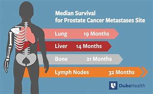 Image result for Cancer Metastasis
