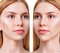 Image result for Smas Face Anatomy