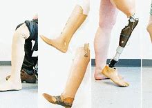 Image result for Prosthetic Limbs Life Like