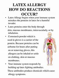 Image result for Human Latex Allergy