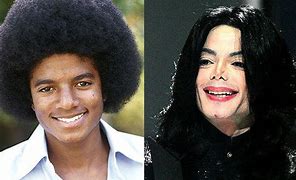 Image result for Michael Jackson Plastic Surgery Gone Wrong