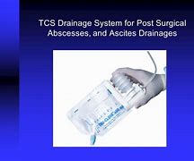 Image result for Uresil Tru-Close Suction System