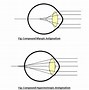 Image result for Inside View of Eye with Astigmatism