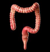 Image result for Large Intestine Real Life
