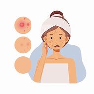 Image result for Pimple Cartoon