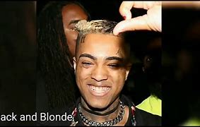 Image result for Xxxtentacion All Hair
