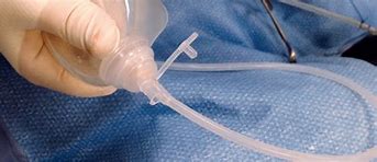 Image result for Closed Surgical Drain