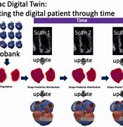 Image result for Digital Twin Heart
