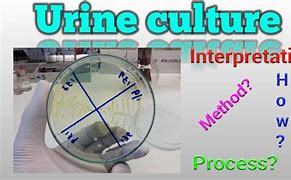 Image result for Urine Culture Process