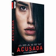Image result for acusad9