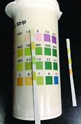 Image result for Urine Test Thank You