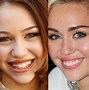 Image result for Pretty People with Bad Teeth