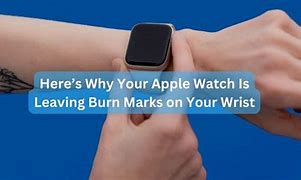 Image result for Apple Watch Wrist Marks