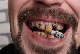 Image result for Yellow Teeth Smoking