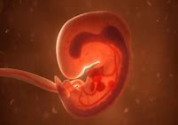 Image result for Types of Anencephaly