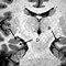 Image result for Vascular Dementia MRI