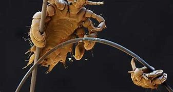Image result for Crabs STD Under Microscope