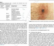 Image result for Rickettsial Rash