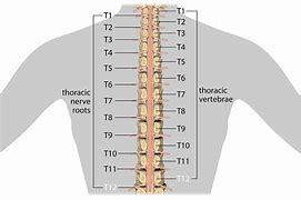 Image result for T12-L1 Disc Herniation Symptoms