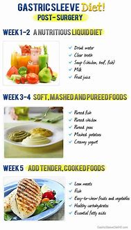 Image result for Gastric Bypass Surgery Diet