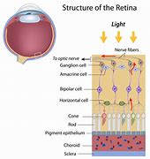 Image result for Right Eye Retina